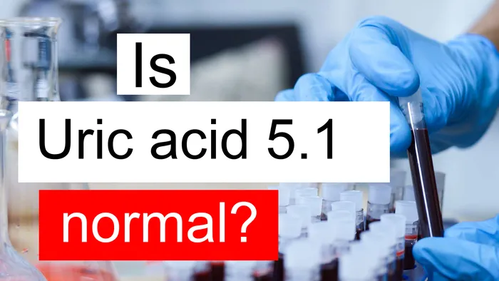 Uric acid 5.1