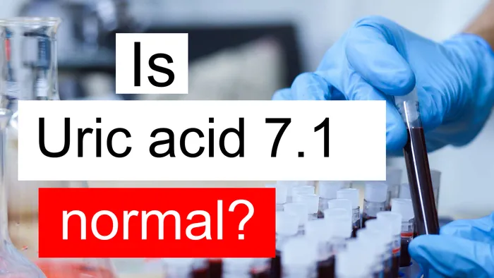 Uric acid 7.1