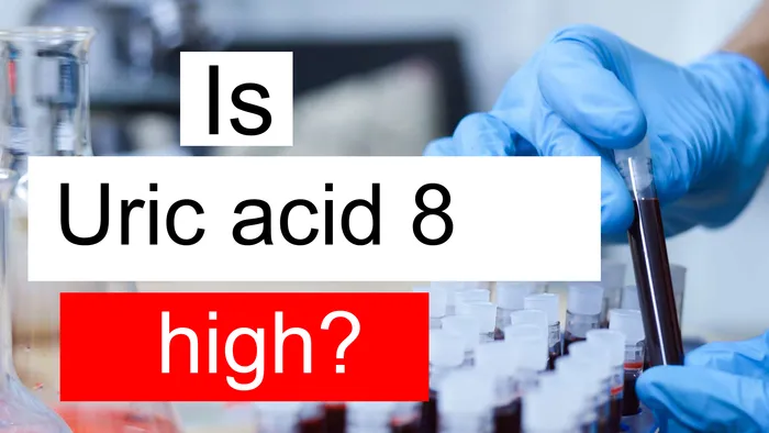 Uric acid 8
