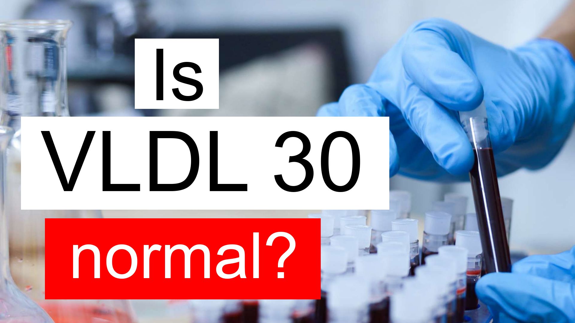 Is VLDL 30 normal, high or low? What does Very low density lipoprotein