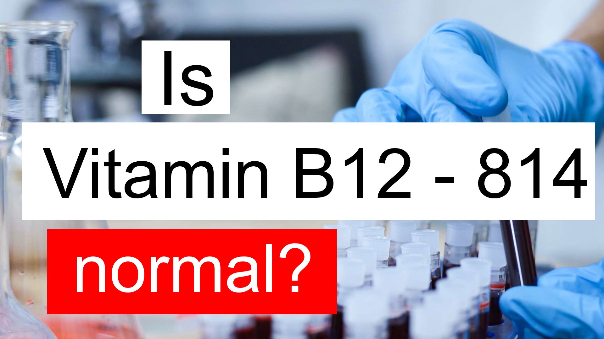 Is Vitamin B12 814 normal, high or low? What does Vitamin B12 level 814