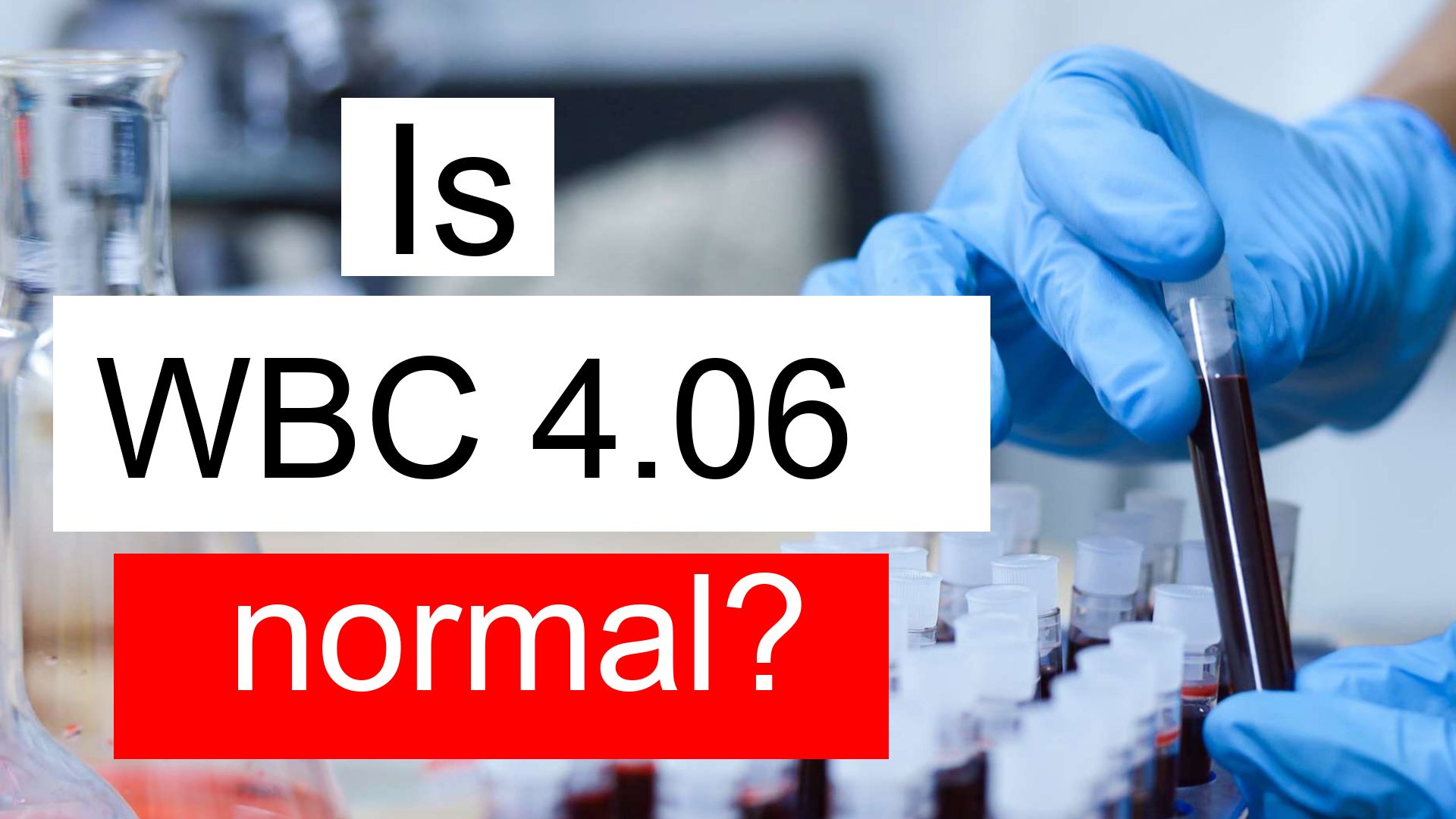 Treatment and symptoms of WBC 4.06 thou/uL | Diet for normal White ...